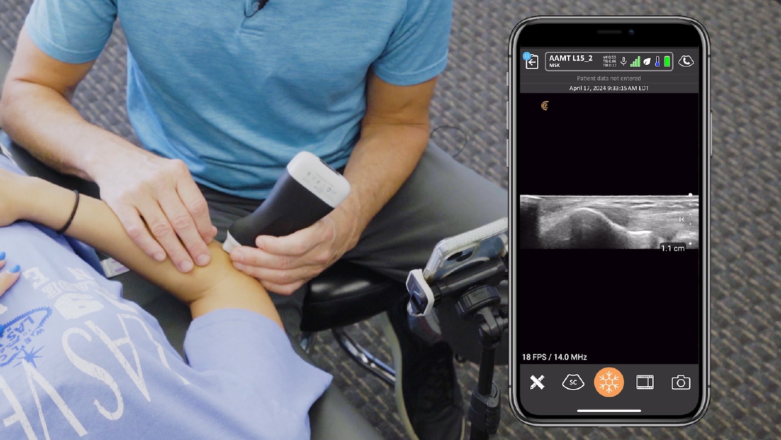 Treatment Options 1 Ultrasound Guided Dry Needling