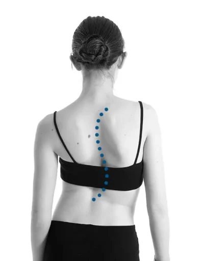 Scoliosis 2 back curve scoliosis sign